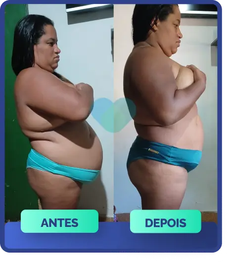 OzenVitta - Imagem dividida mostrando o antes e depois de uma mulher segurando um pote de OzenVitta. Na primeira parte da imagem ela aparece acima do peso e na outra parte, percebesse que houve uma perde de peso e gordura